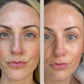 FaceGym PRO LED Maske