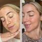 FaceGym PRO LED Maske