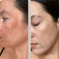 FaceGym PRO LED Maske
