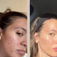 FaceGym PRO LED Maske